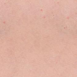 Seamless Textures of Human Skin + Normal & Bump Mapping